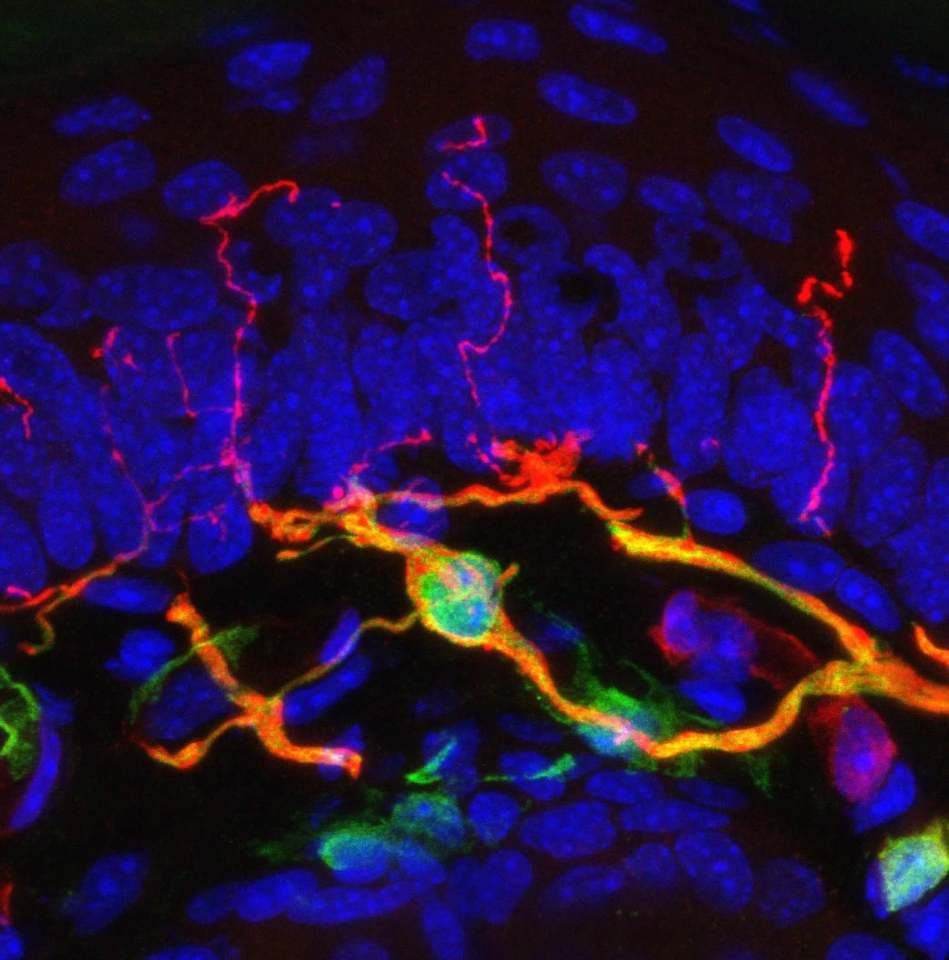 Πόνος: Ανακάλυψαν νέο όργανο στο δέρμα που τον προκαλεί